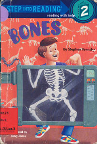 Bones